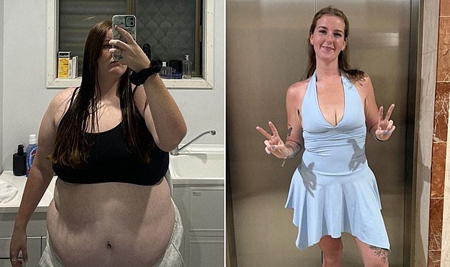 Žena vážila 140 kilo a nenáviděla své tělo. Co stálo za radikálním zhubnutím?